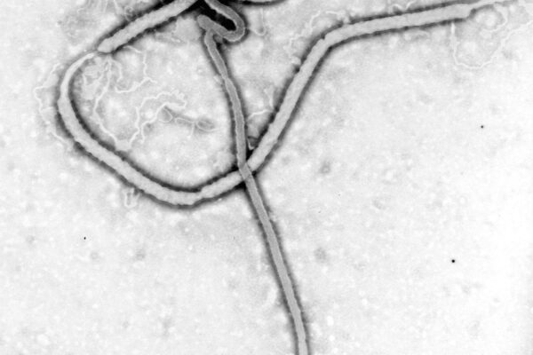 The Ebola virus under an electron microscope