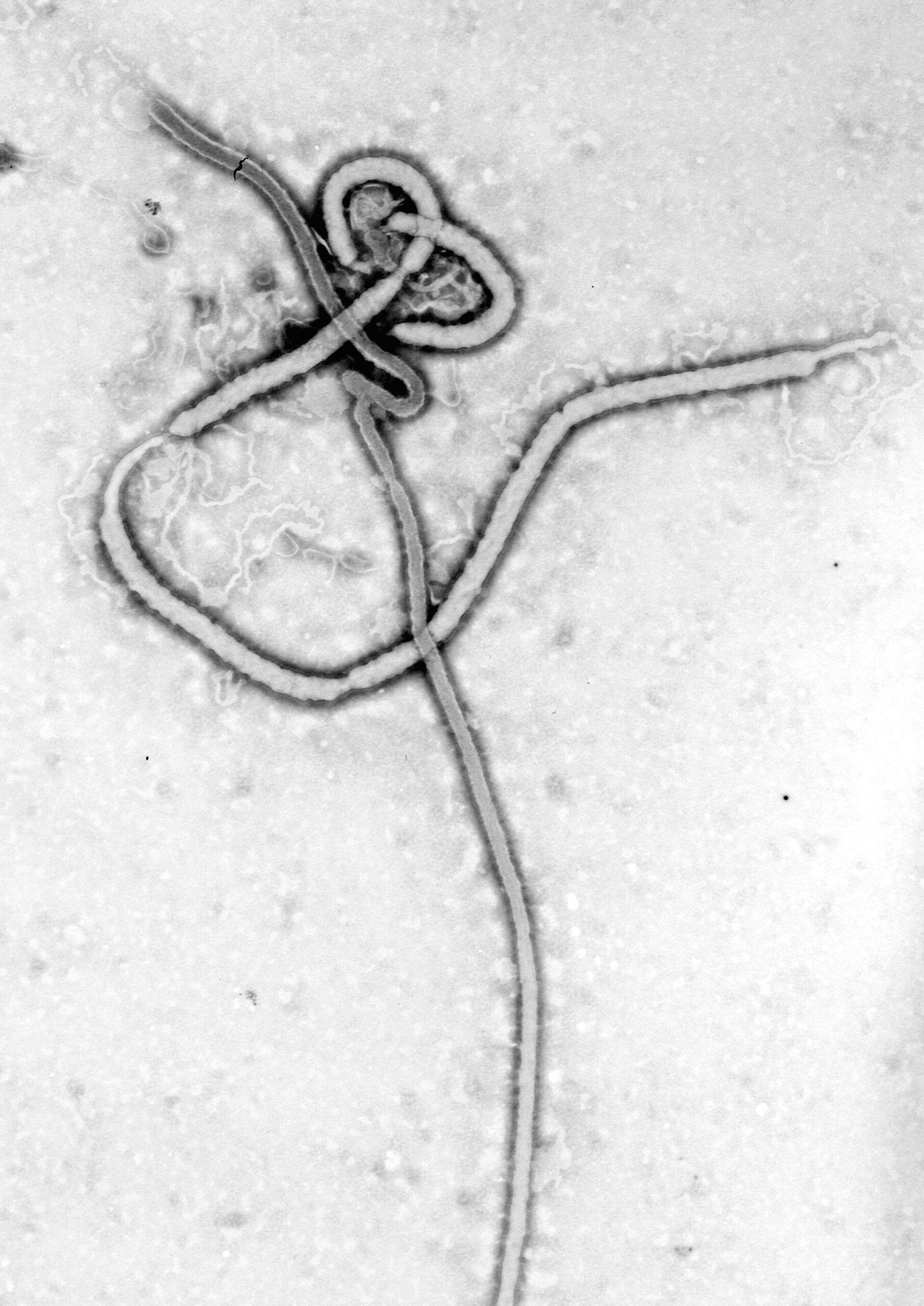The Ebola virus under an electron microscope