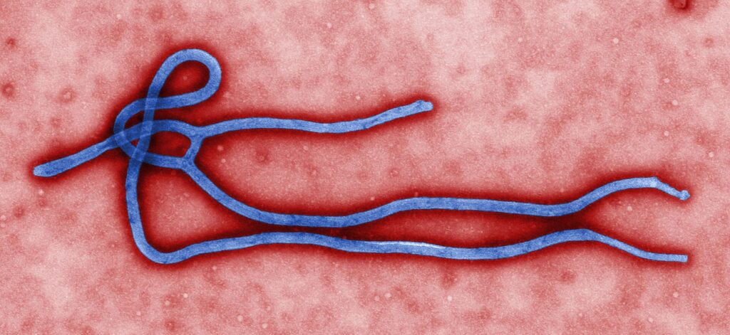 Colorized electron microscope image of a filament-shaped Ebola virus particle