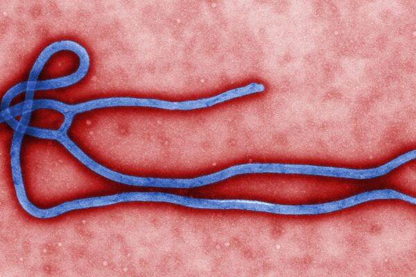 Colorized electron microscope image of a filament-shaped Ebola virus particle