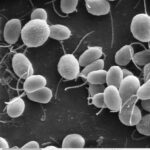 Black-and-white electron microscope image of round single-celled algae with whip-like flagella