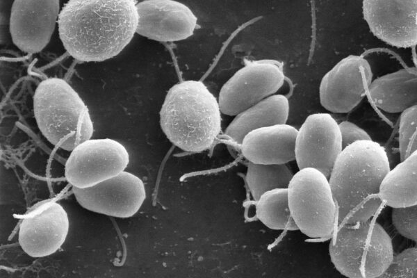 Black-and-white electron microscope image of round single-celled algae with whip-like flagella