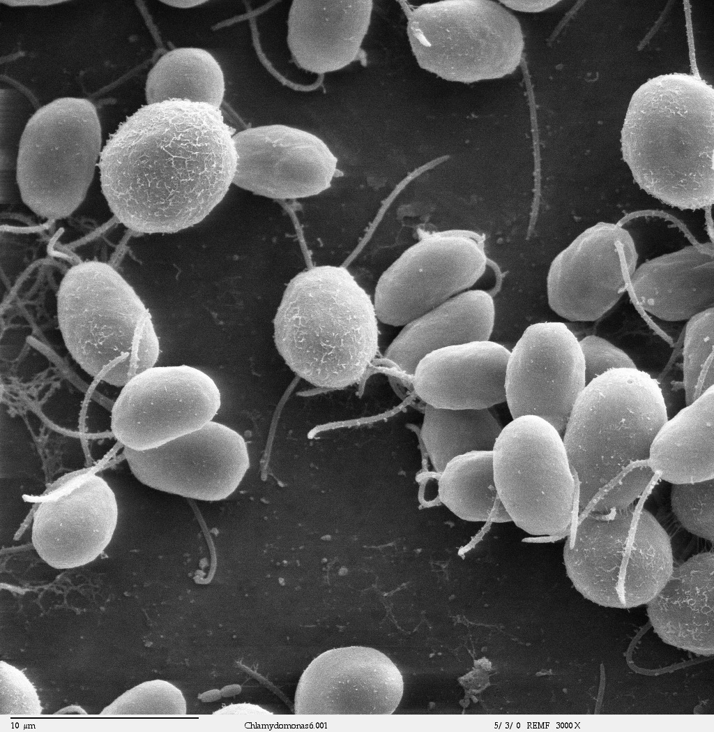 Black-and-white electron microscope image of round single-celled algae with whip-like flagella