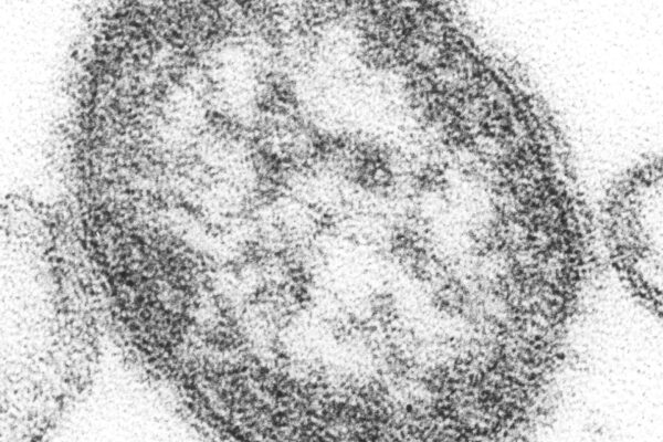 Grainy black-and-white electron microscope image of a round measles virus particle