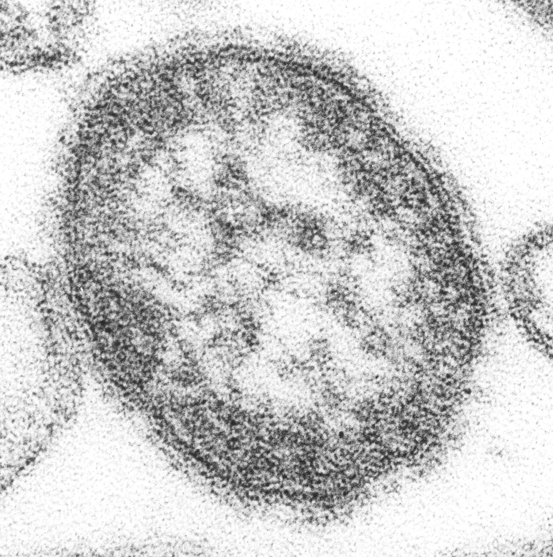 Grainy black-and-white electron microscope image of a round measles virus particle