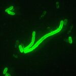Death of Siberian Plague-Lab Worker Fuels Fears of Pneumonic Plague as Russia Offers Shifting Explanations